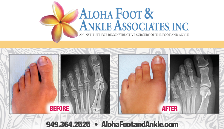 Aloha Foot & Ankle