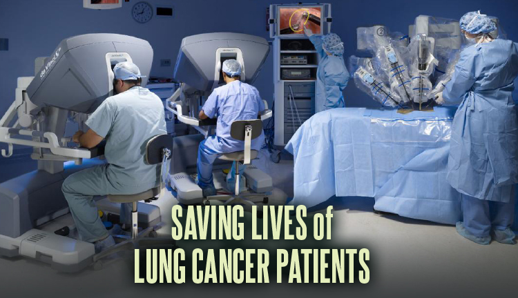Saving Lives of Lung Cancer Patients