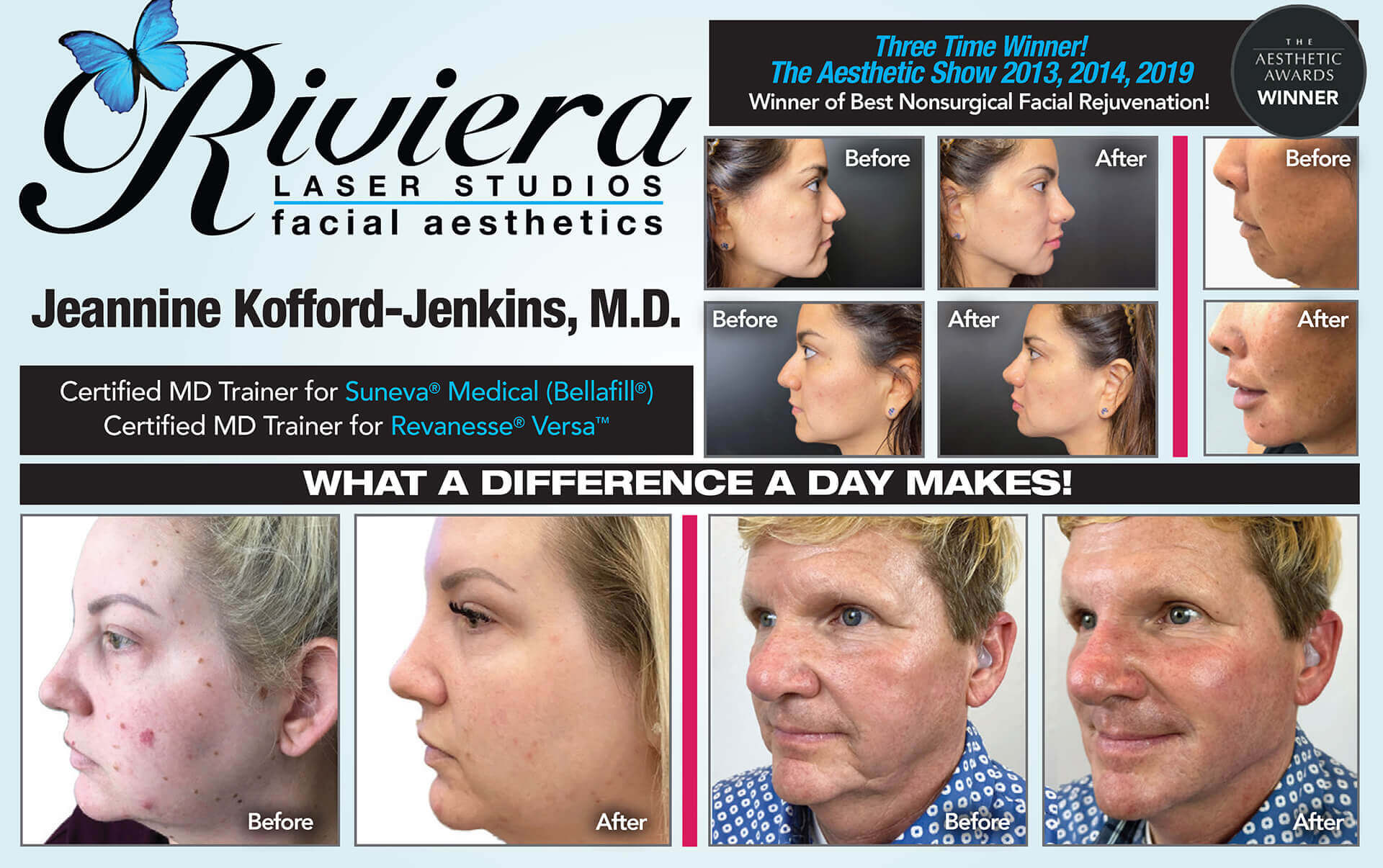 Riviera Laser Studios